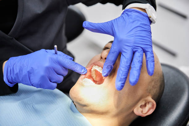 Best Emergency Dentist for Lost Fillings or Crowns in Eldorado At Santa Fe, NM